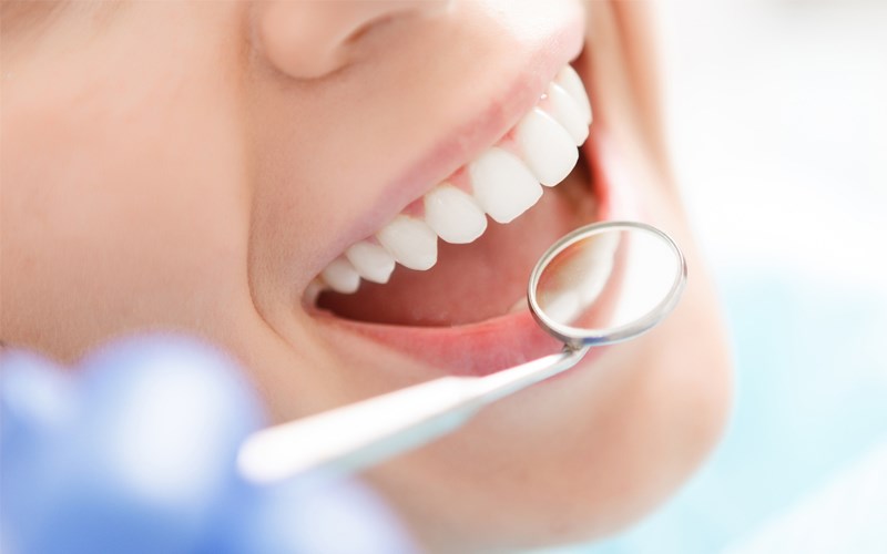 Cải thiện sức khỏe răng miệng