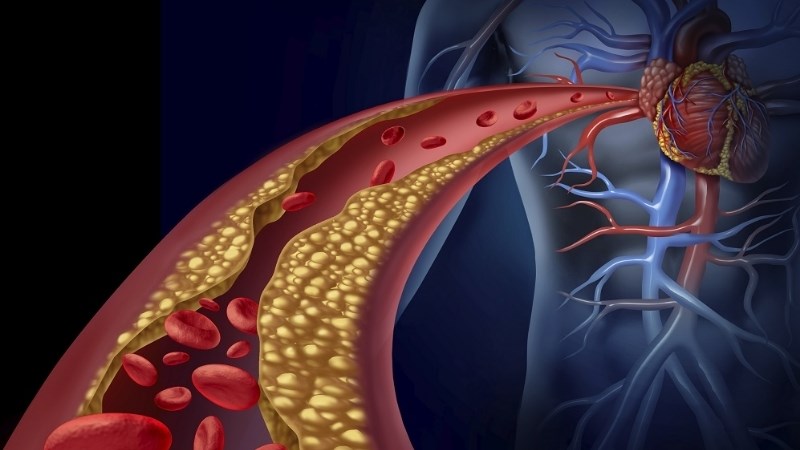 Nguồn cholesterol tốt
