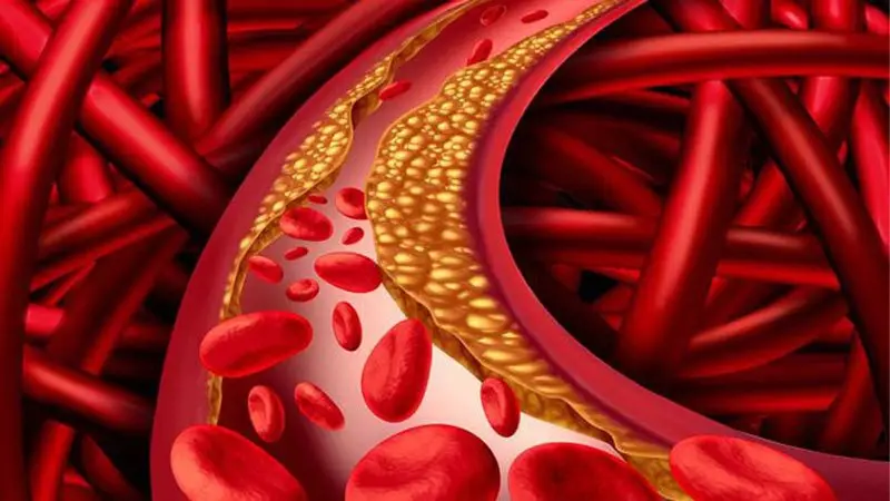 Làm giảm lượng cholesterol