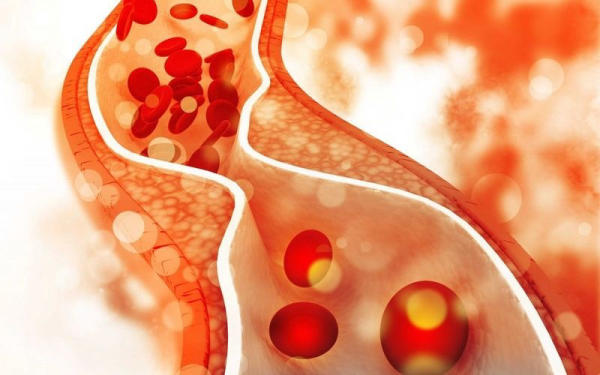 Giảm cholesterol