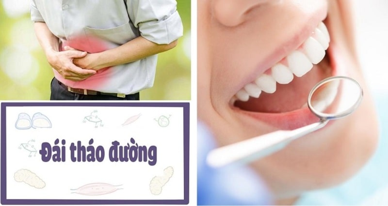 Tác dụng tuyệt vời của quả lựu và cách ăn lựu tốt cho sức khỏe