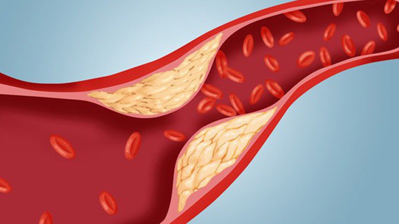 Giảm lượng cholesterol