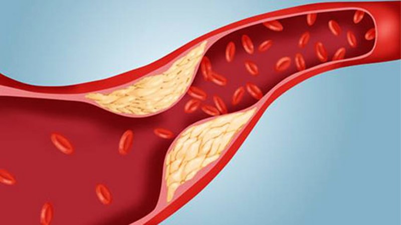 Giúp hạ cholesterol