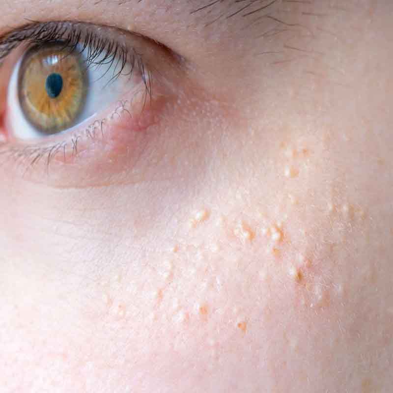 Chữa ngoài da khô sần, mụn nhọt lở ngứa, vết thương lâu lành