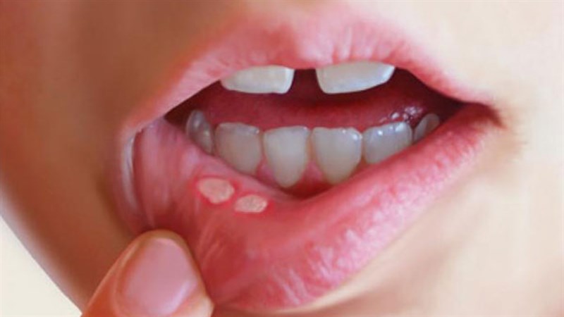 Giải nhiệt cơ thể