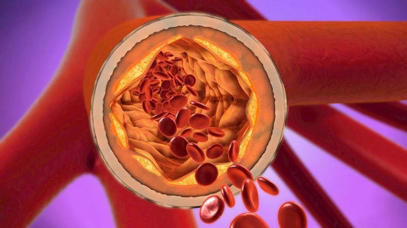 Giảm lượng cholesterol