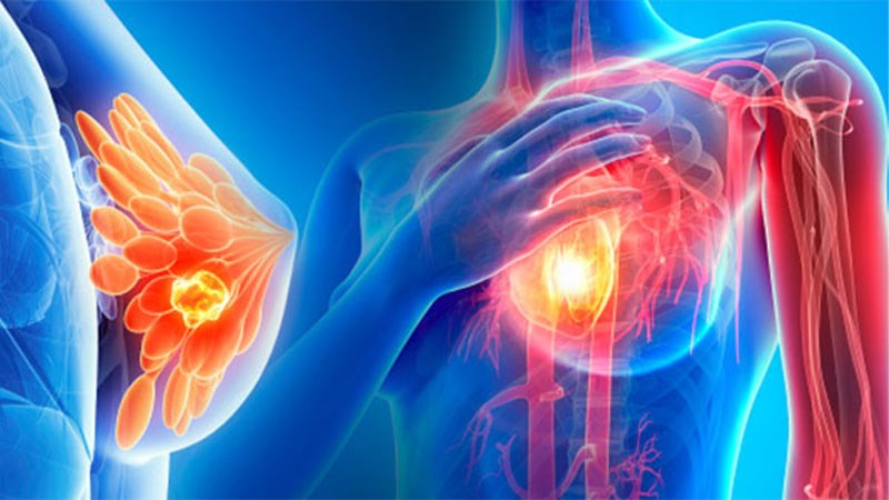 Sâm tố nữ có tác dụng chống ung thư