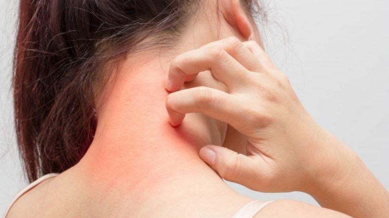 Có thể không gây dị ứng