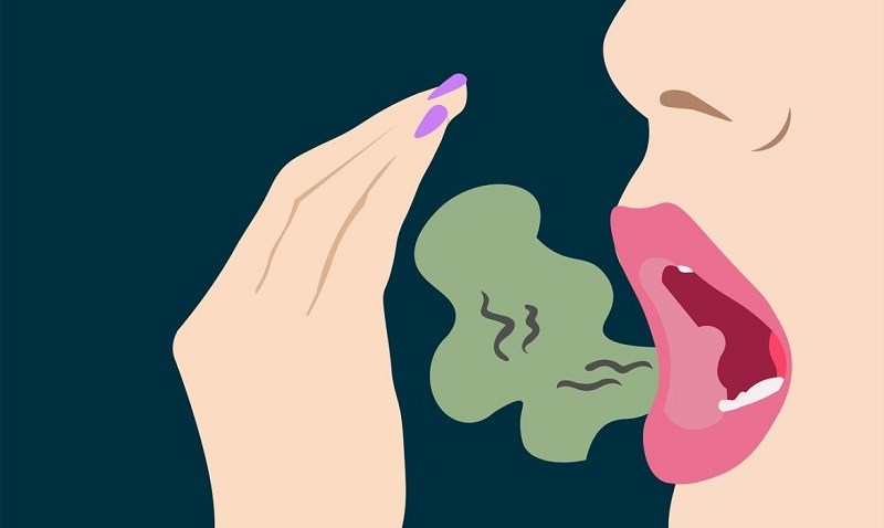 Tiêu diệt vi khuẩn gây hôi miệng