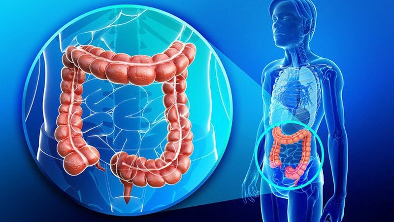 Có thể làm giảm nguy cơ ung thư đại trực tràng