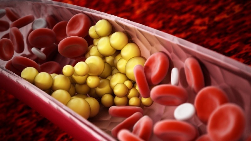 Giảm cholesterol