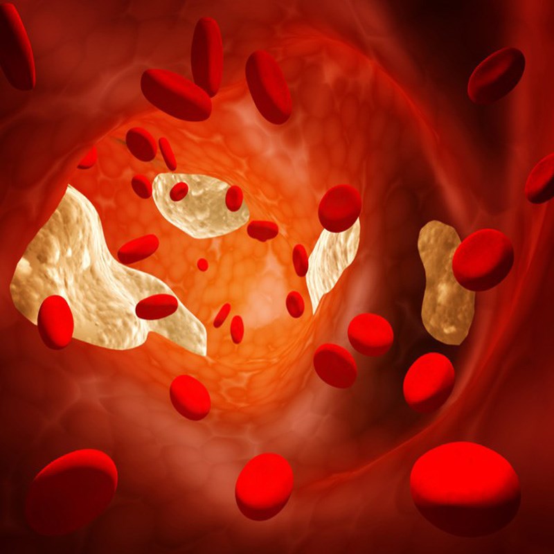 Làm giảm nồng độ cholesterol