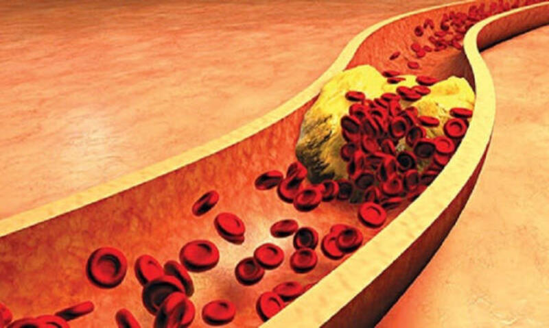 Giảm cholesterol
