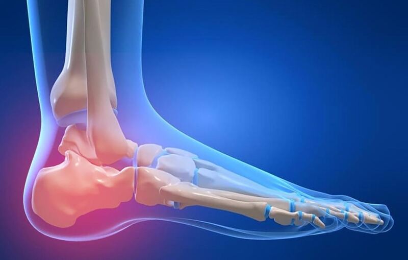 Triệu chứng khi đau gót chân khi chạy bộ