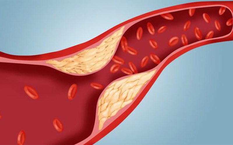 Điều hòa lượng cholesterol