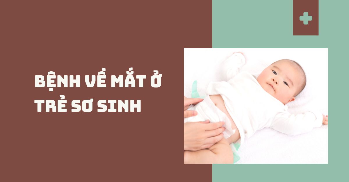 Bệnh về mắt ở trẻ sơ sinh