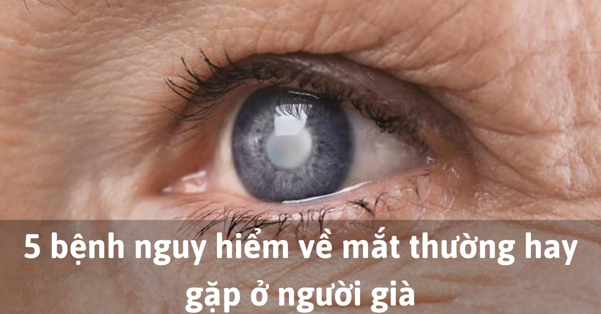Các bệnh về mắt ở người già