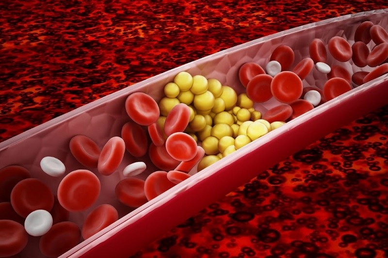 Cân bằng cholesterol