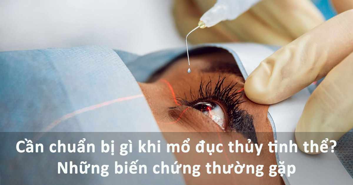 mổ đục thủy tinh thể