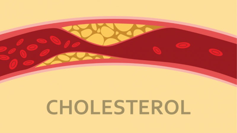 Cải thiện lượng cholesterol