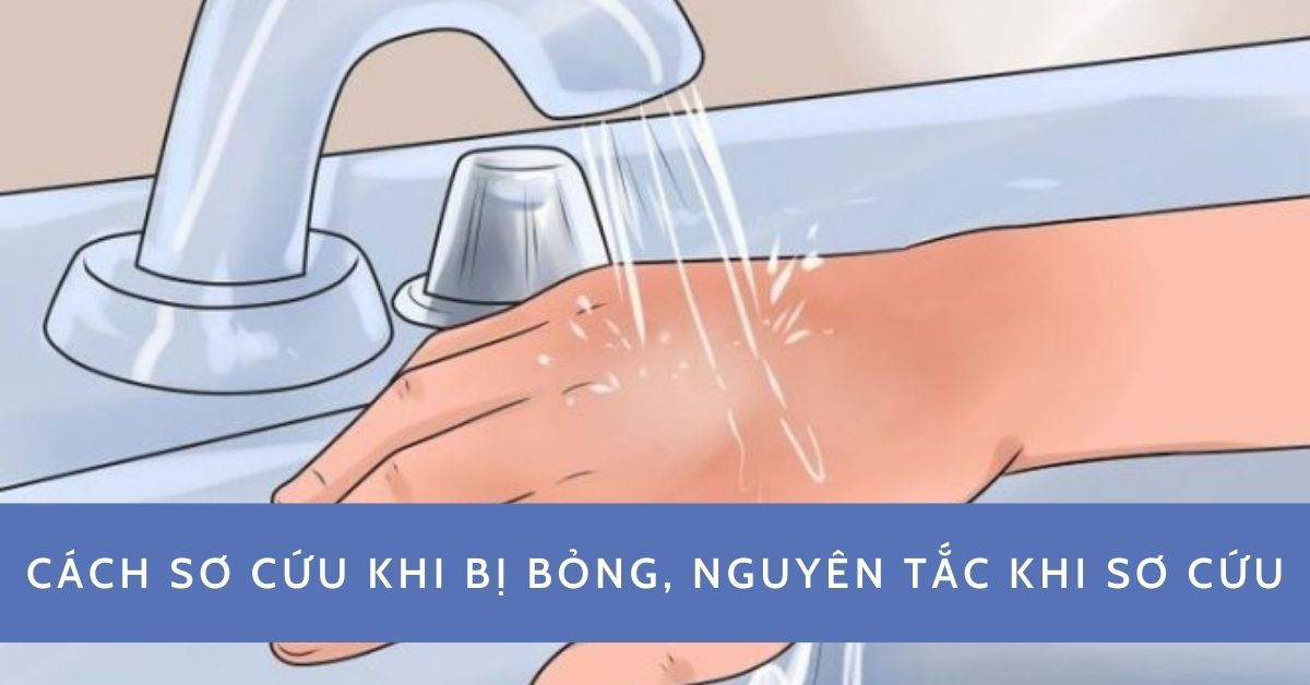 Cách sơ cứu khi bị bỏng