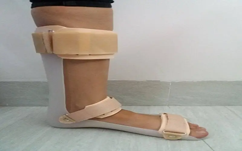 Nẹp cố định bàn chân