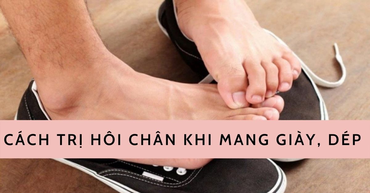 cách trị hôi chân khi mang giày