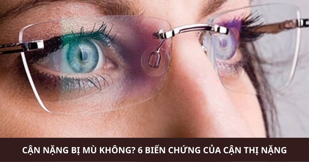 Cận nặng bị mù không?