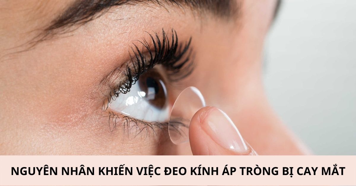 Đeo kính áp tròng bị cay mắt