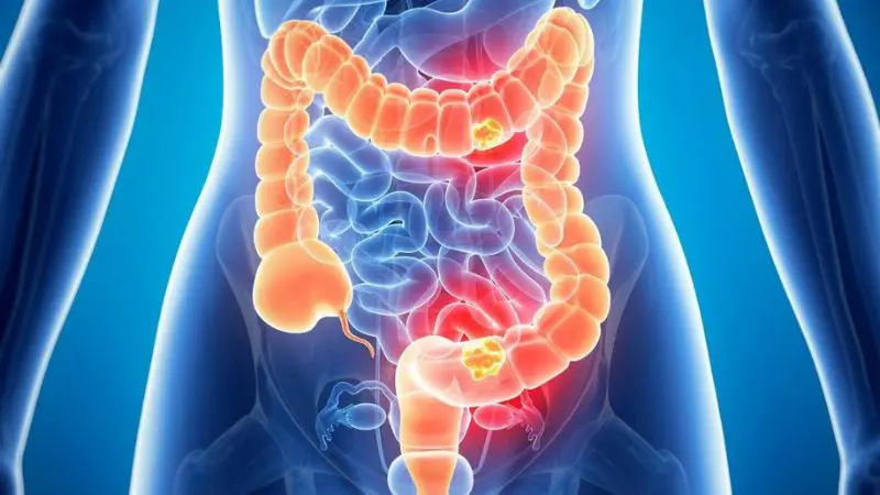 Tăng cường nhu động ruột