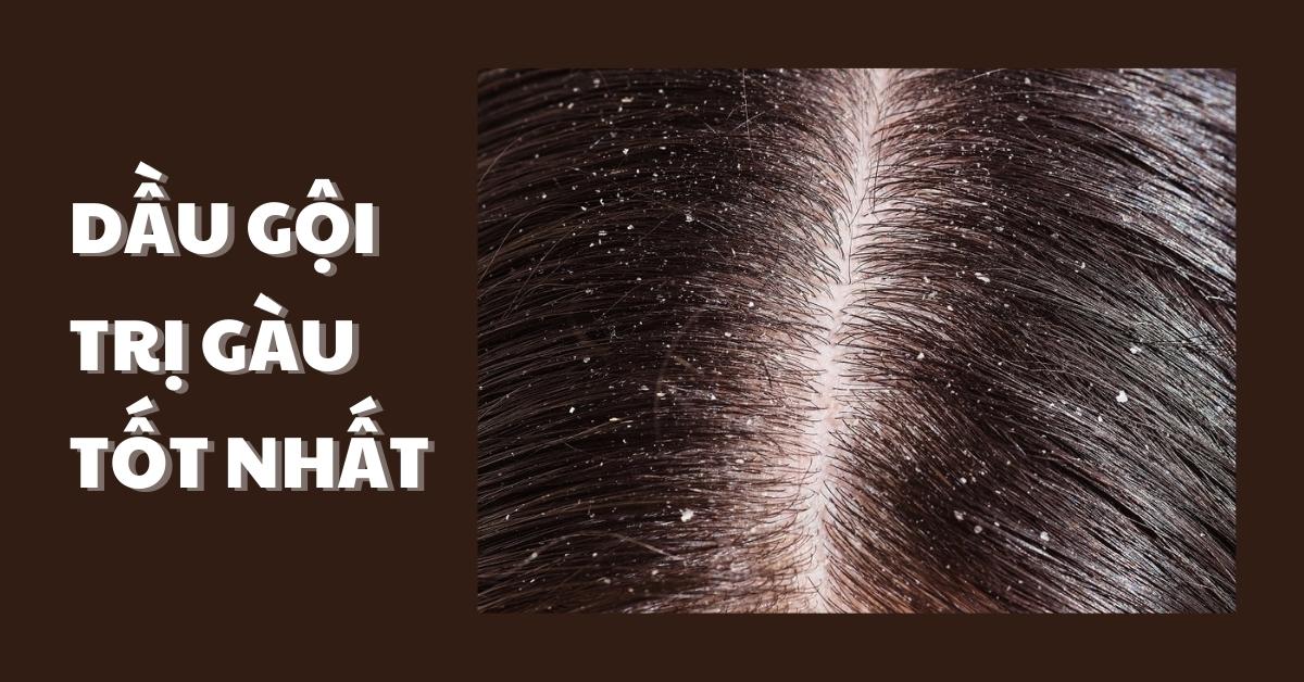 dầu gội trị gàu tốt nhất