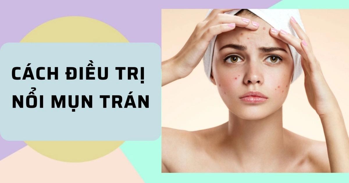 Nguyên nhân và các cách điều trị nổi mụn trán hiệu quả