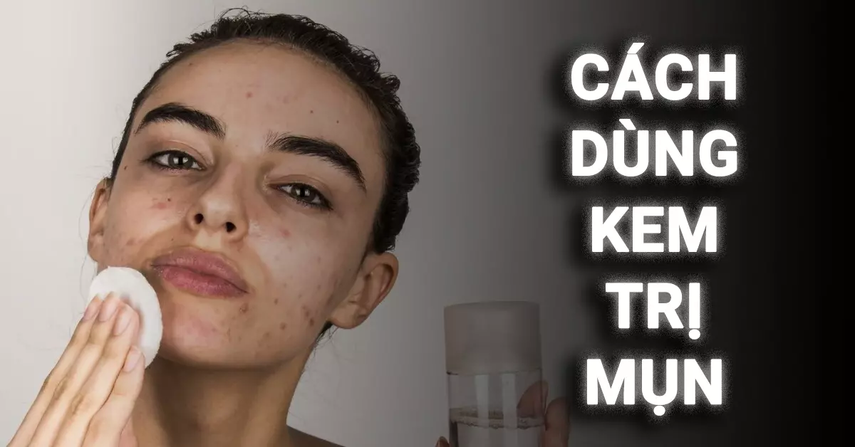 cách dùng kem trị mụn