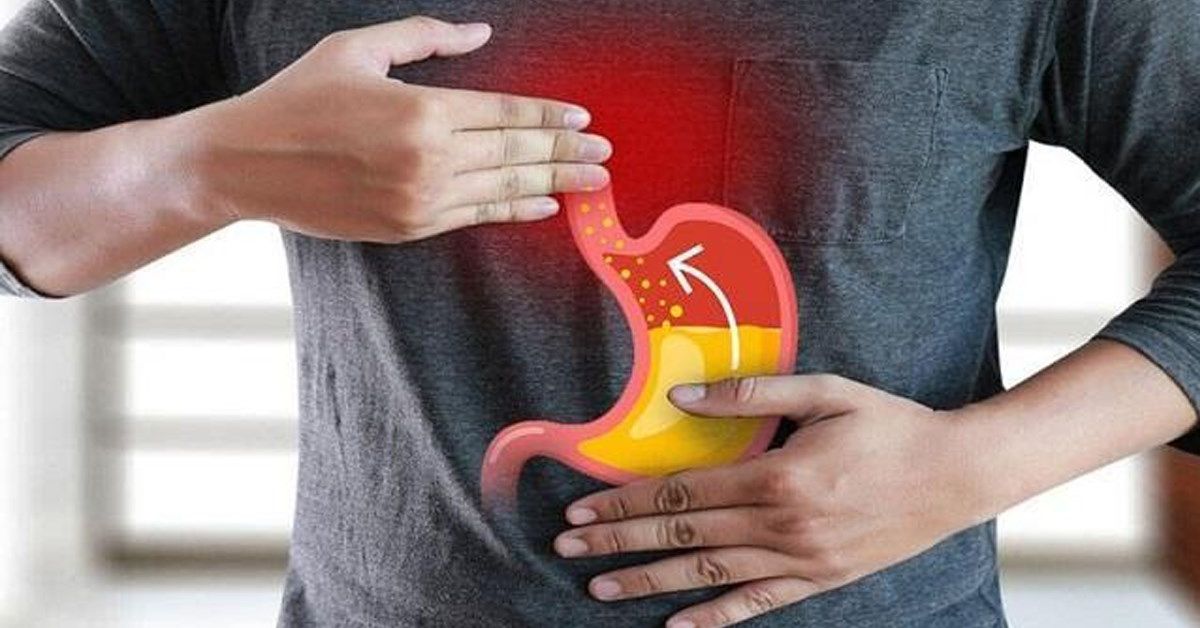 trào ngược dạ dày nên ăn gì