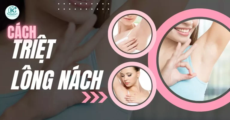 cách triệt lông nách