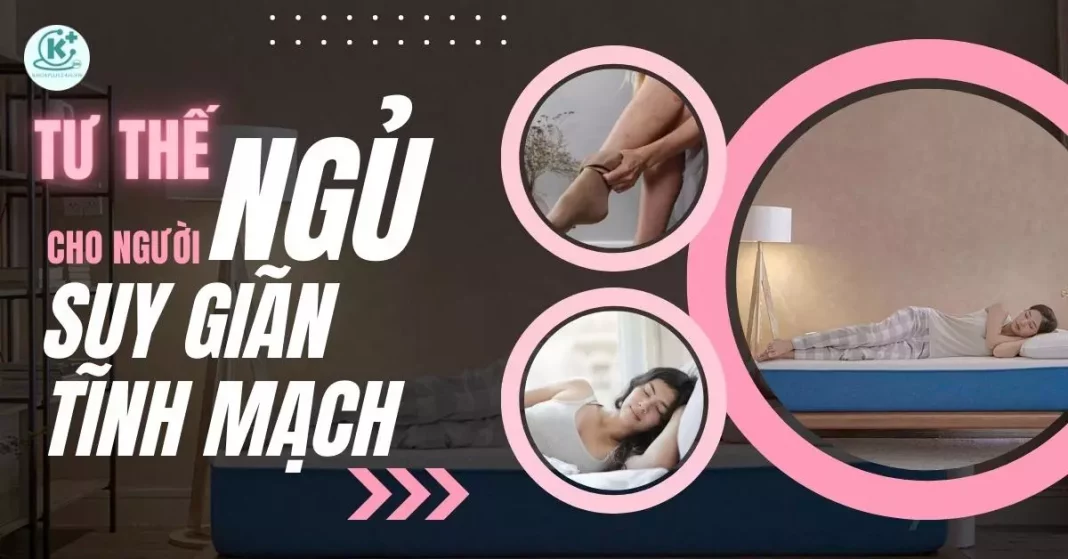 tư thế ngủ cho người suy giãn tĩnh mạch