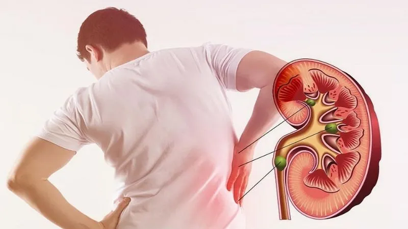 Ăn bánh chưng có thể khiến cơ thể bị rối loạn mỡ máu và tăng mỡ máu