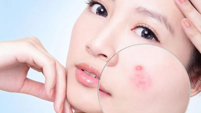 Gạo nếp là thành phần chính làm nên bánh chưng, có tính nóng sẽ gây nóng trong người