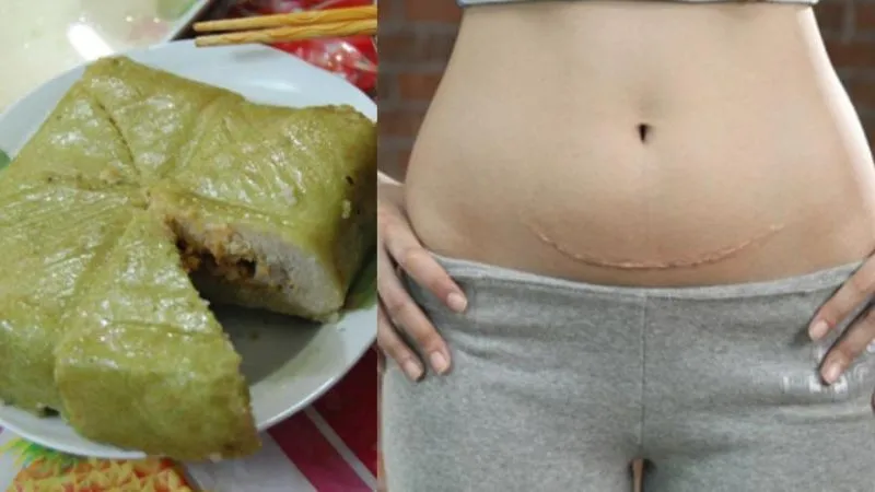 Phụ nữ sinh mổ thì tuyệt đối không nên ăn bánh chưng