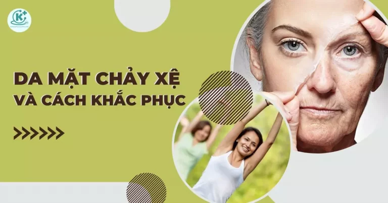 da mặt chảy xệ