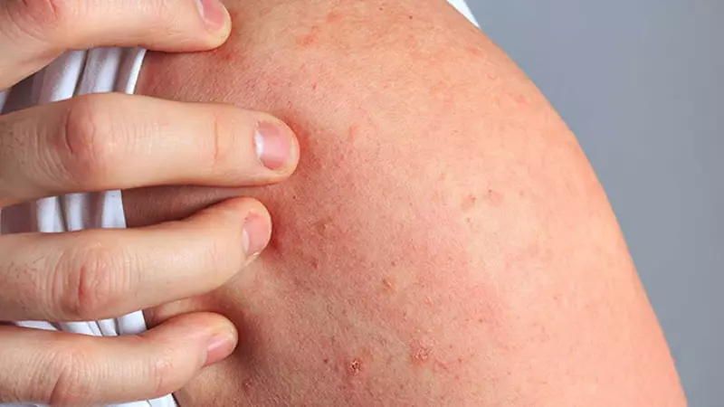 Có khả năng gây ra dị ứng qua các triệu chứng như phát ban, buồn nôn, chóng mặt, đau đầu...