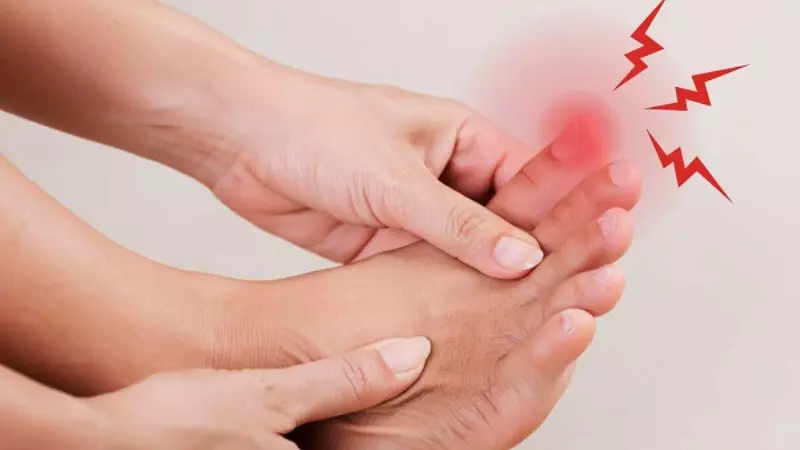 Vitamin C có thể giảm nguy cơ mắc bệnh gout