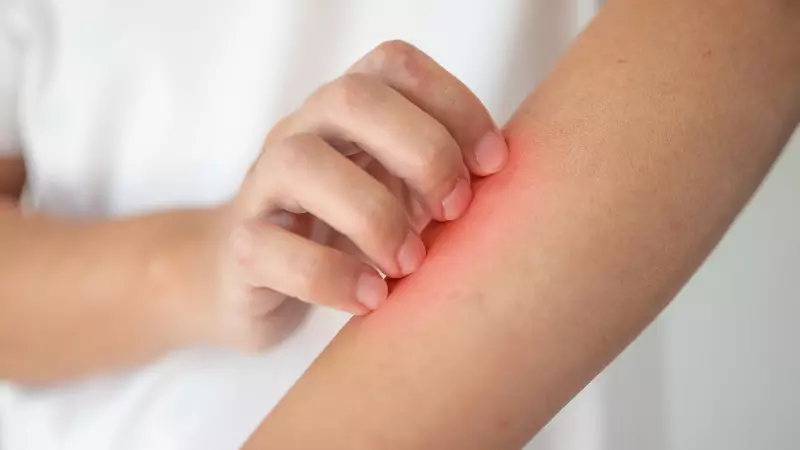 Lá ớt có khả năng gây kích ứng cho da